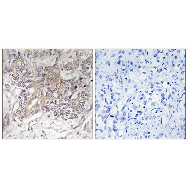 Immunohistochemistry - Anti-GCNT3 Antibody (C14708) - Antibodies.com