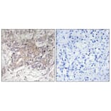 Immunohistochemistry - Anti-GCNT3 Antibody (C14708) - Antibodies.com