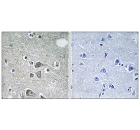 Immunohistochemistry - Anti-FBLN2 Antibody (C15753) - Antibodies.com