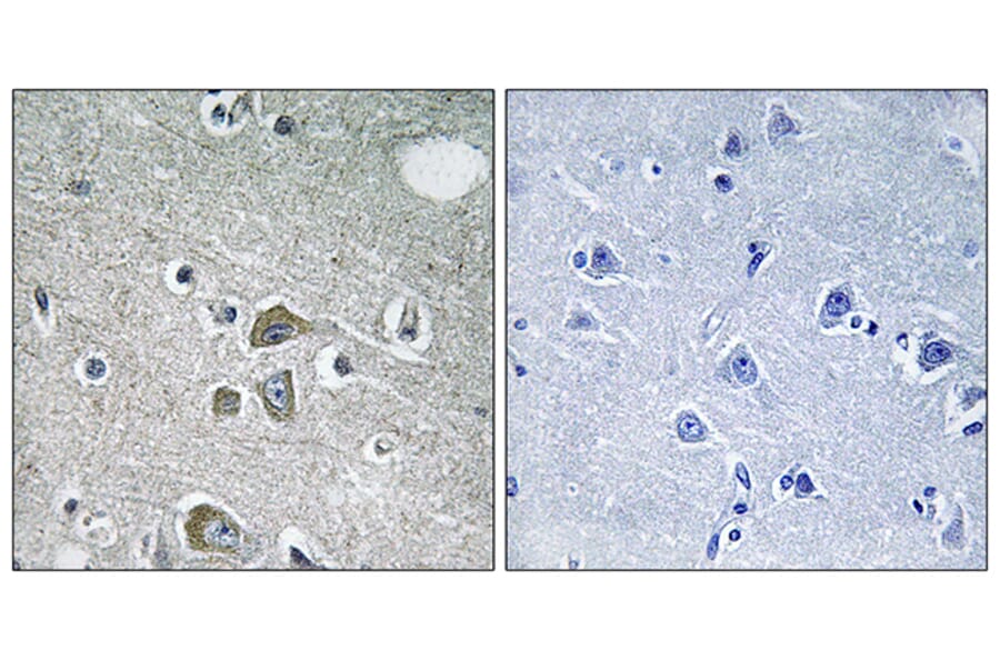 Immunohistochemistry - Anti-FBLN2 Antibody (C15753) - Antibodies.com