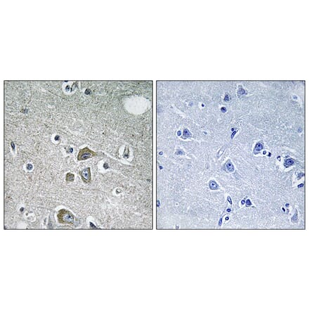 Immunohistochemistry - Anti-FBLN2 Antibody (C15753) - Antibodies.com