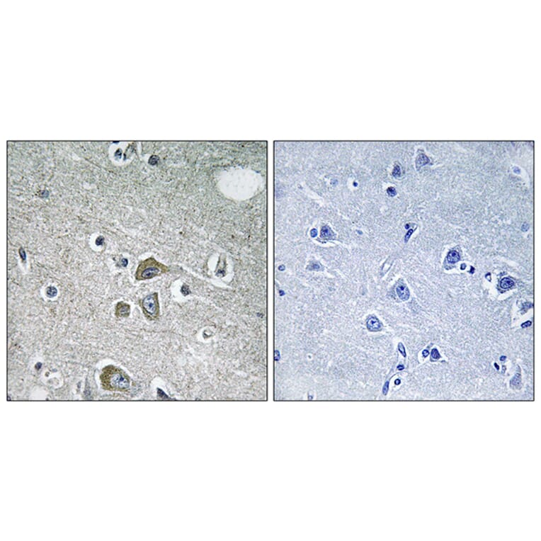 Immunohistochemistry - Anti-FBLN2 Antibody (C15753) - Antibodies.com