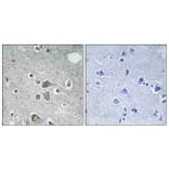 Immunohistochemistry - Anti-FBLN2 Antibody (C15753) - Antibodies.com