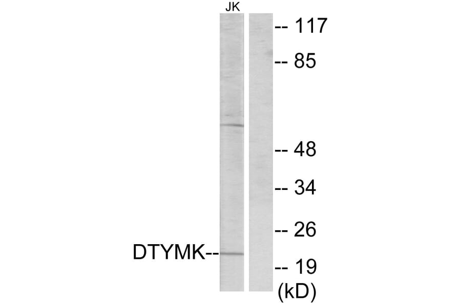 Western Blot - Anti-DTYMK Antibody (C10468) - Antibodies.com