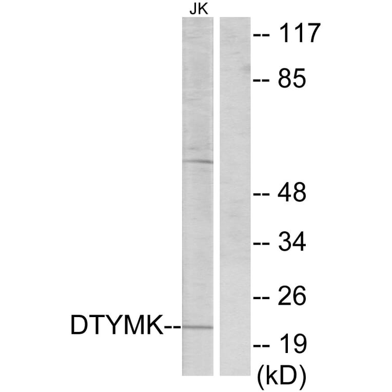 Western Blot - Anti-DTYMK Antibody (C10468) - Antibodies.com