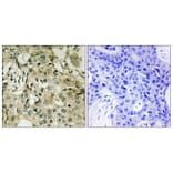 Immunohistochemistry - Anti-DTYMK Antibody (C10468) - Antibodies.com