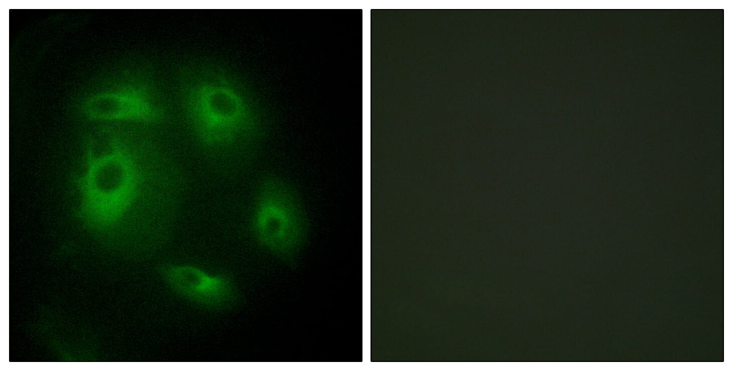 Immunofluorescence analysis of HeLa cells using Anti-DLEC1 Antibody. The right hand panel represents a negative control, where the antibody was pre-incubated with the immunising peptide.