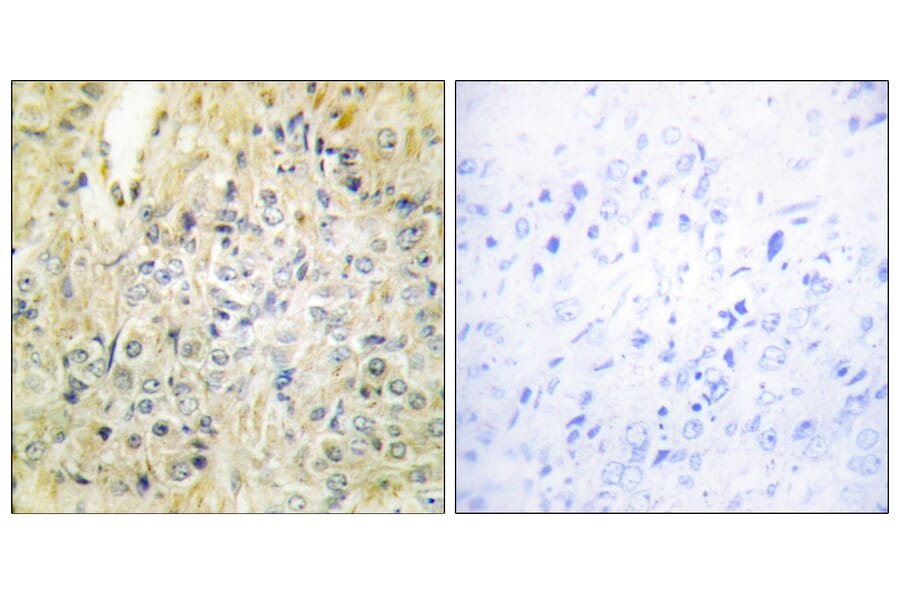 Immunohistochemistry - Anti-DLEC1 Antibody (C11919) - Antibodies.com