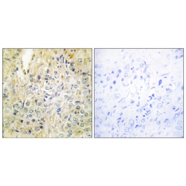Immunohistochemistry - Anti-DLEC1 Antibody (C11919) - Antibodies.com