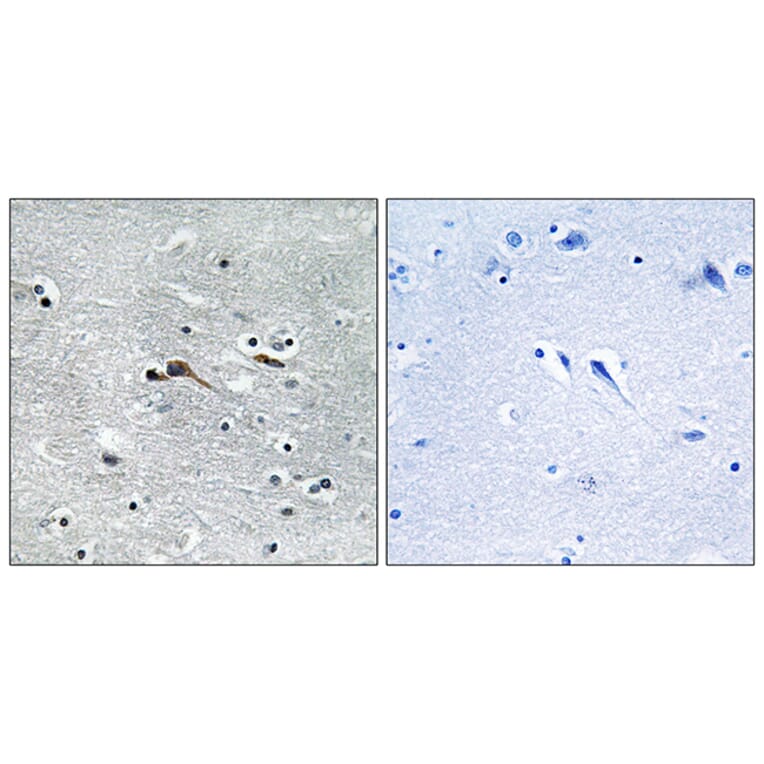 Immunohistochemistry - Anti-CYTL1 Antibody (C12324) - Antibodies.com