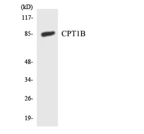 Western Blot - Anti-CPT1B Antibody (R12-2650) - Antibodies.com