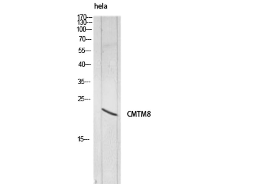 Western Blot - Anti-CMTM8 Antibody (C30721) - Antibodies.com