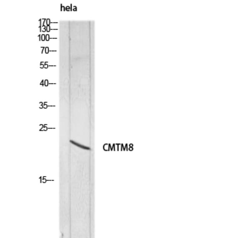 Western Blot - Anti-CMTM8 Antibody (C30721) - Antibodies.com