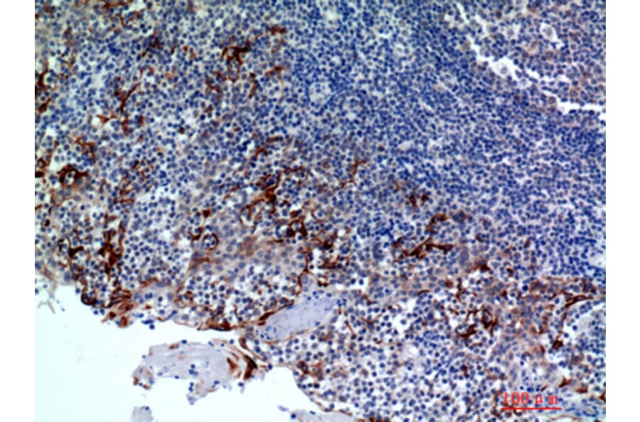 Immunohistochemistry - Anti-CMTM8 Antibody (C30721) - Antibodies.com