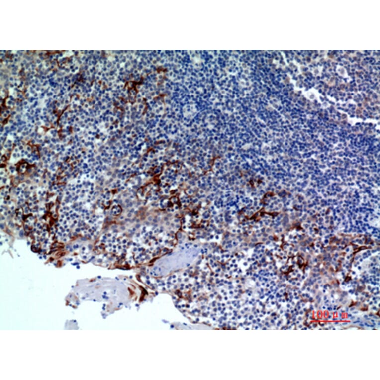 Immunohistochemistry - Anti-CMTM8 Antibody (C30721) - Antibodies.com