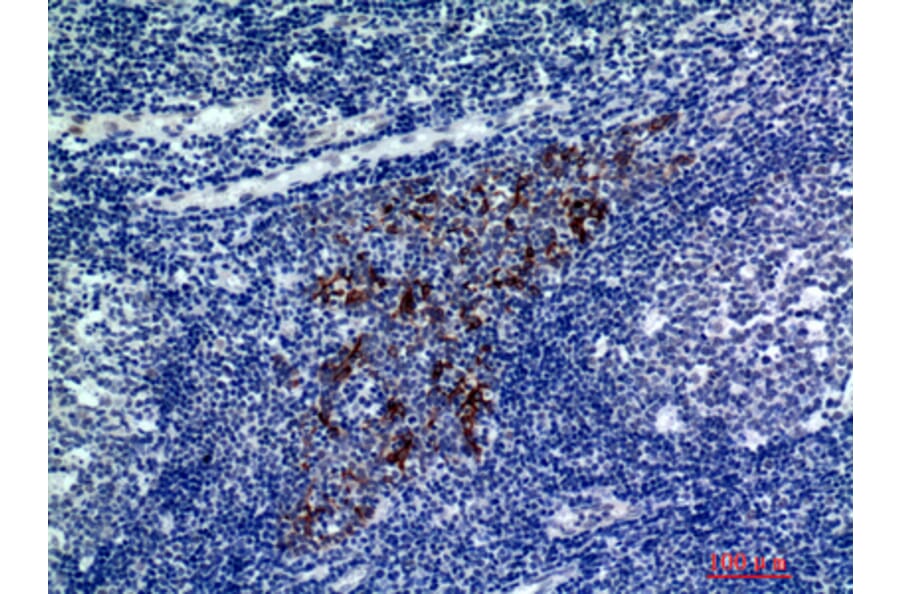 Immunohistochemistry - Anti-CMTM8 Antibody (C30721) - Antibodies.com