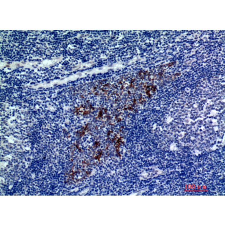 Immunohistochemistry - Anti-CMTM8 Antibody (C30721) - Antibodies.com