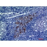 Immunohistochemistry - Anti-CMTM8 Antibody (C30721) - Antibodies.com