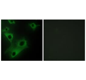 Immunofluorescence - Anti-CIDEC Antibody (C12188) - Antibodies.com