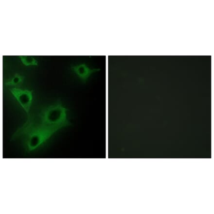 Immunofluorescence - Anti-CIDEC Antibody (C12188) - Antibodies.com