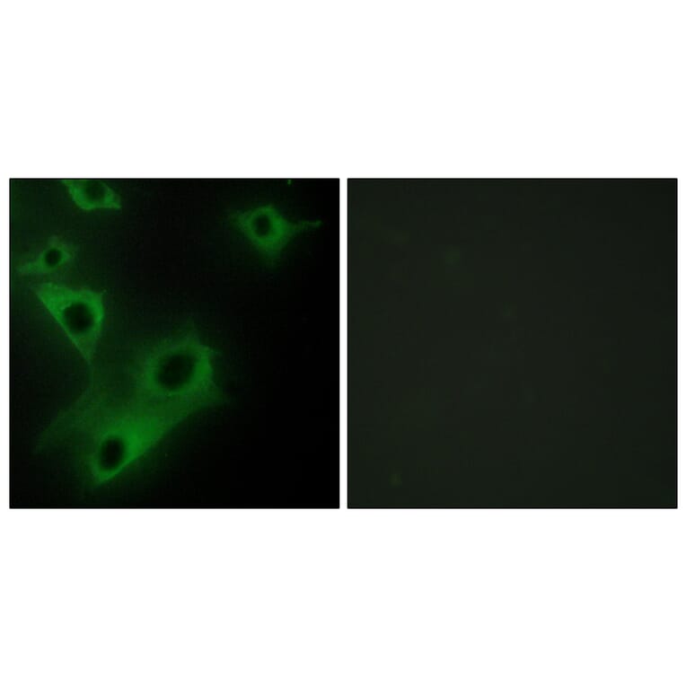 Immunofluorescence - Anti-CIDEC Antibody (C12188) - Antibodies.com