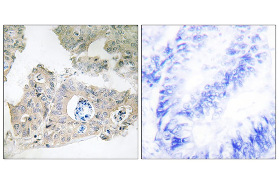 Immunohistochemistry - Anti-CIDEC Antibody (C12188) - Antibodies.com