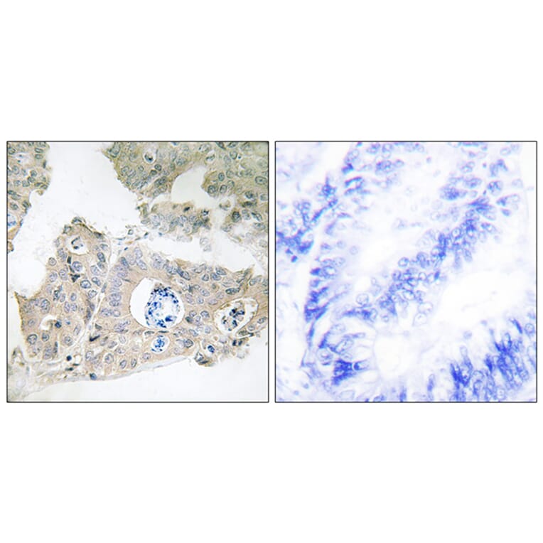 Immunohistochemistry - Anti-CIDEC Antibody (C12188) - Antibodies.com