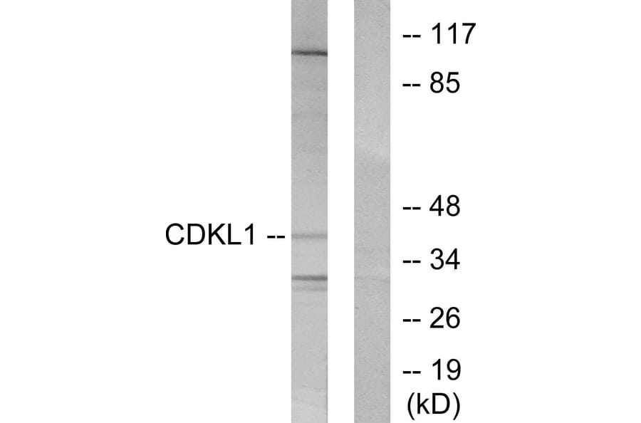 Western Blot - Anti-CDKL1 Antibody (C10820) - Antibodies.com