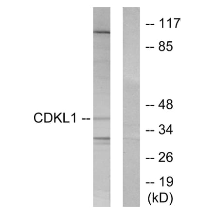 Western Blot - Anti-CDKL1 Antibody (C10820) - Antibodies.com
