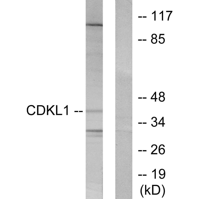 Western Blot - Anti-CDKL1 Antibody (C10820) - Antibodies.com