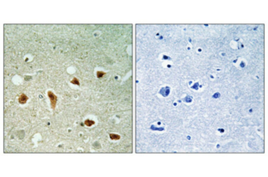 Immunohistochemistry - Anti-CDKL1 Antibody (C10820) - Antibodies.com