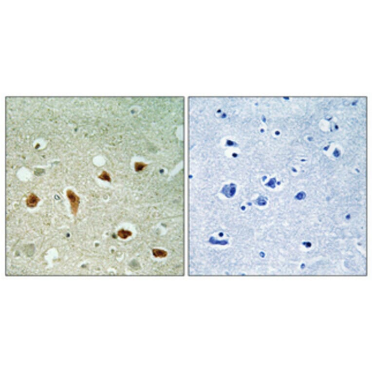 Immunohistochemistry - Anti-CDKL1 Antibody (C10820) - Antibodies.com