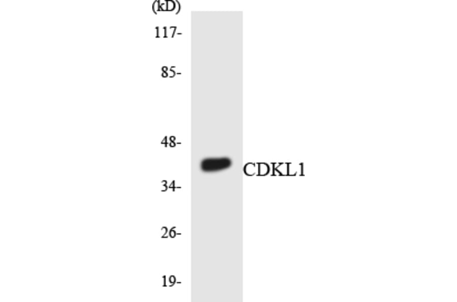 Western Blot - Anti-CDKL1 Antibody (R12-2608) - Antibodies.com
