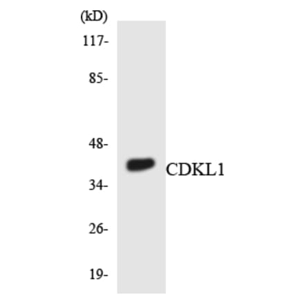 Western Blot - Anti-CDKL1 Antibody (R12-2608) - Antibodies.com