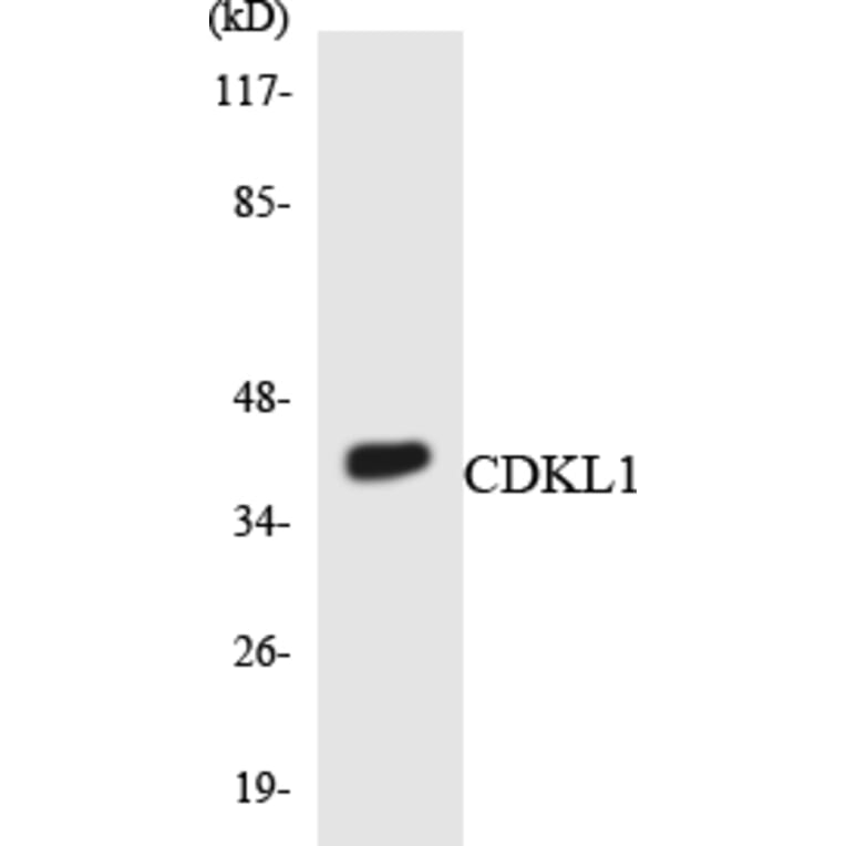 Western Blot - Anti-CDKL1 Antibody (R12-2608) - Antibodies.com