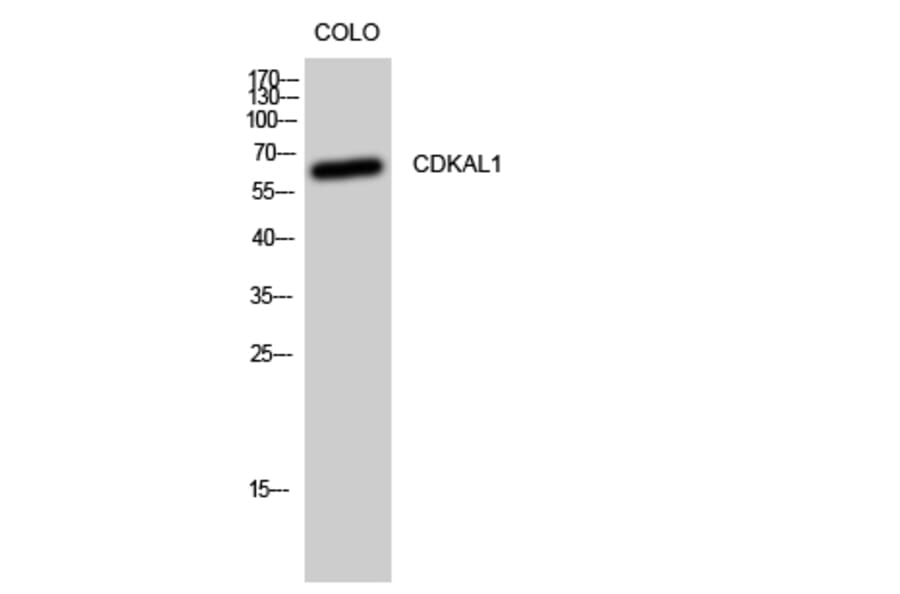 Western Blot - Anti-CDKAL Antibody (C12178) - Antibodies.com