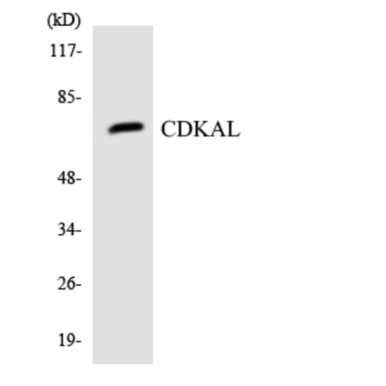 Western Blot - Anti-CDKAL Antibody (R12-2606) - Antibodies.com