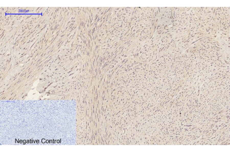 Immunohistochemistry - Anti-CASP1 Antibody (C30122) - Antibodies.com