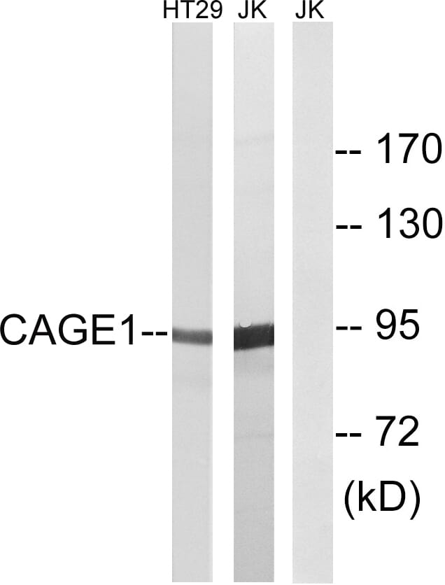 Western blot analysis of lysates from HT-29 and Jurkat cells using Anti-CAGE1 Antibody. The right hand lane represents a negative control, where the antibody is blocked by the immunising peptide.