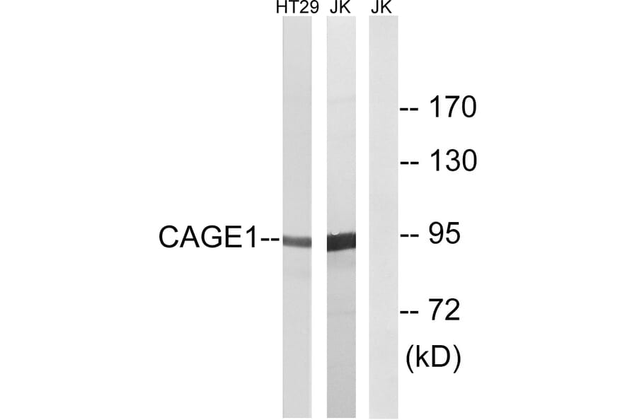Western Blot - Anti-CAGE1 Antibody (C14912) - Antibodies.com
