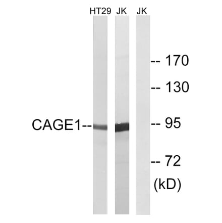 Western Blot - Anti-CAGE1 Antibody (C14912) - Antibodies.com
