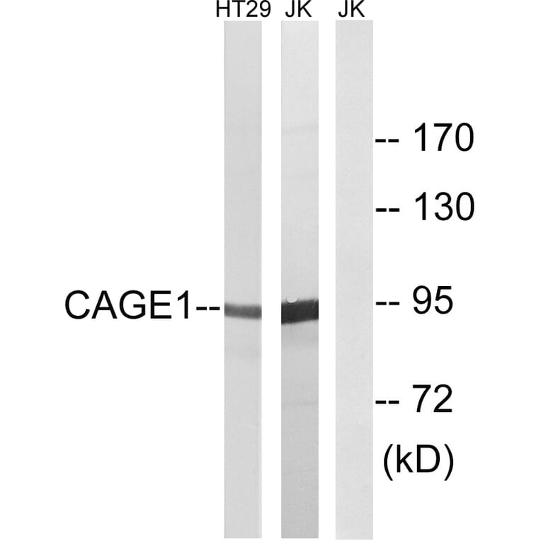 Western Blot - Anti-CAGE1 Antibody (C14912) - Antibodies.com