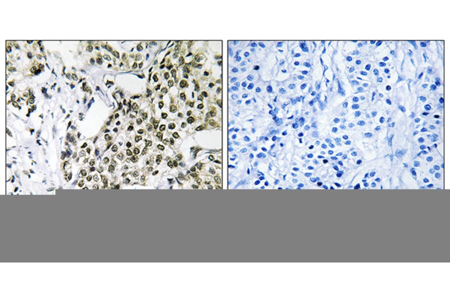 Immunohistochemistry - Anti-CAGE1 Antibody (C14912) - Antibodies.com