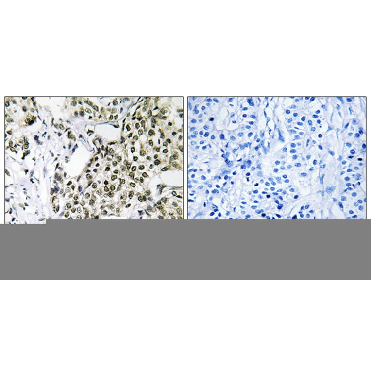 Immunohistochemistry - Anti-CAGE1 Antibody (C14912) - Antibodies.com