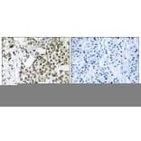 Immunohistochemistry - Anti-CAGE1 Antibody (C14912) - Antibodies.com