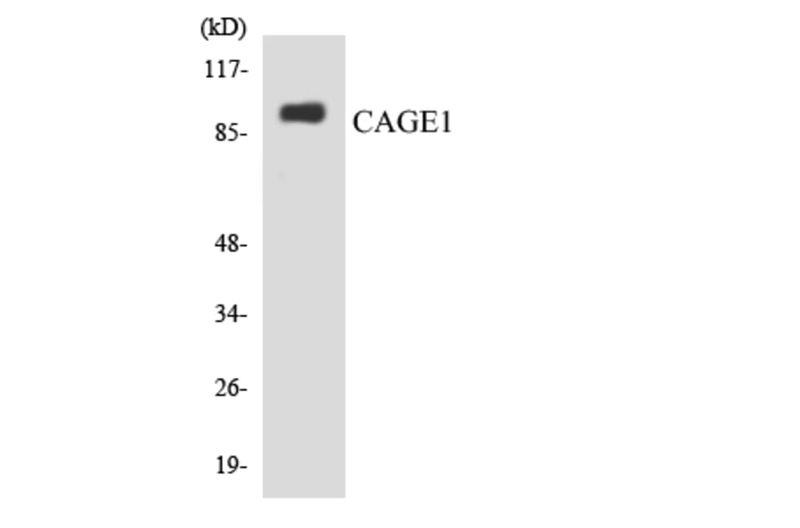 Western Blot - Anti-CAGE1 Antibody (R12-2564) - Antibodies.com