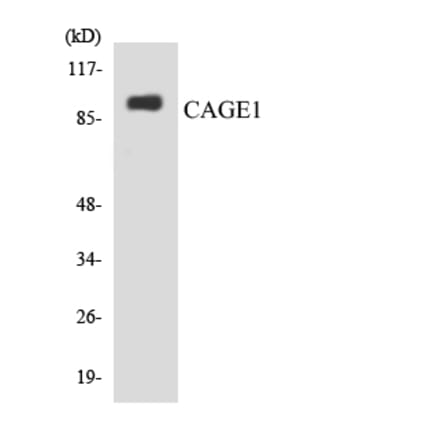Western Blot - Anti-CAGE1 Antibody (R12-2564) - Antibodies.com