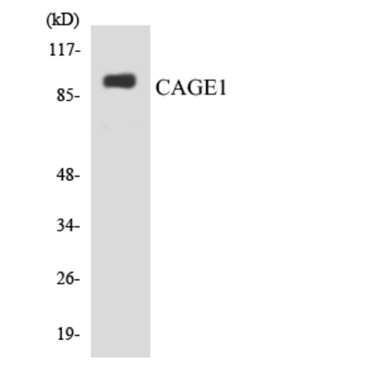 Western Blot - Anti-CAGE1 Antibody (R12-2564) - Antibodies.com