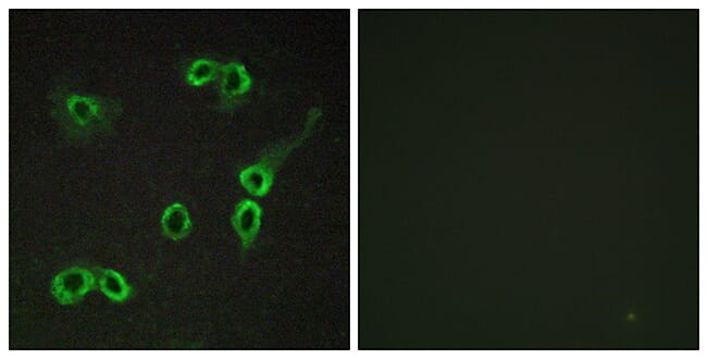 Immunofluorescence analysis of COS7 cells using Anti-C3AR1 Antibody. The right hand panel represents a negative control, where the antibody was pre-incubated with the immunising peptide.