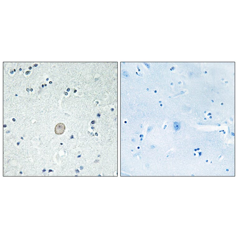 Immunohistochemistry - Anti-C3AR1 Antibody (G028) - Antibodies.com